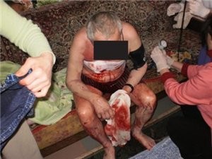 В Крыму 13-летний мальчик порезал ножом своего деда
